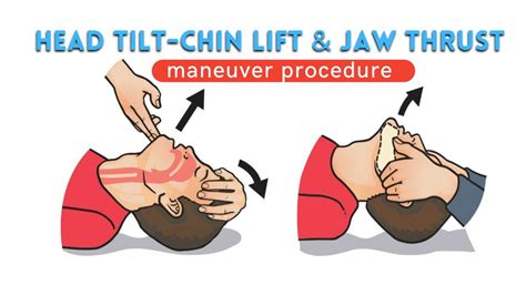Jaw-Thrust Maneuver. The jaw-thrust without head tilt maneuver for airway opening should be taught to both lay rescuers and healthcare providers. Place one hand on each side of the victim’s head, resting your elbows on the surface on which the victim is lying. Grasp the angles of the victim’s lower jaw and lift with both hands (Figure 9 ... 